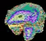 otak, ilustrasi, peta otak, pemetaan otak, irisan otak berwarna
