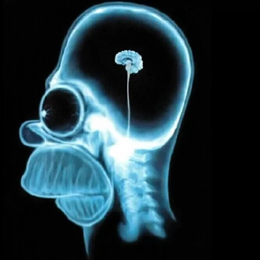 rayo x, homer simpson brain, cerebro de homer simpson, homer simpson brain x, homer's brain of simpson x ray