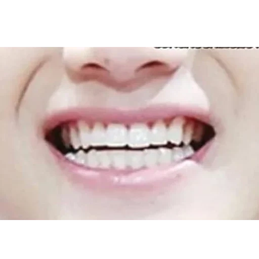 gigi, tersenyumlah, kesehatan gigi, gigi kecil, pemutih gigi