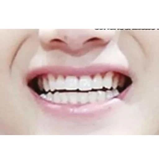 les dents, le sourire, les dents sont saines, petites dents, dents blanches