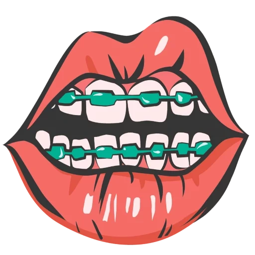 parla con i denti, la bocca aperta, apparecchio dentale pop art, bocca aperta con i denti