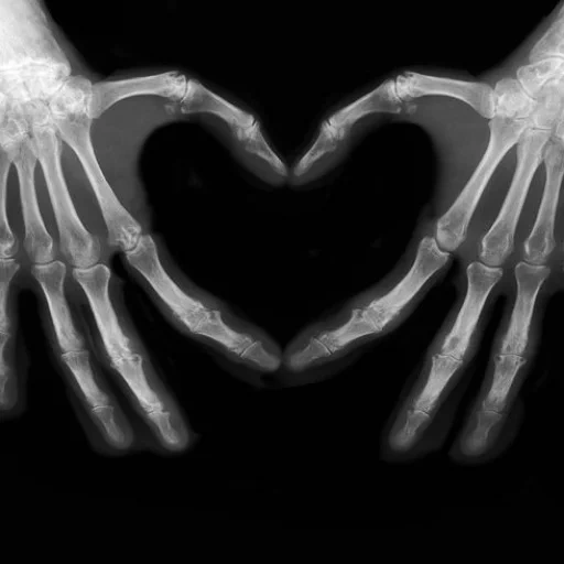 рентген, рентген руки, рентгеновские лучи, рентген виде сердца, руки скелета сердечко