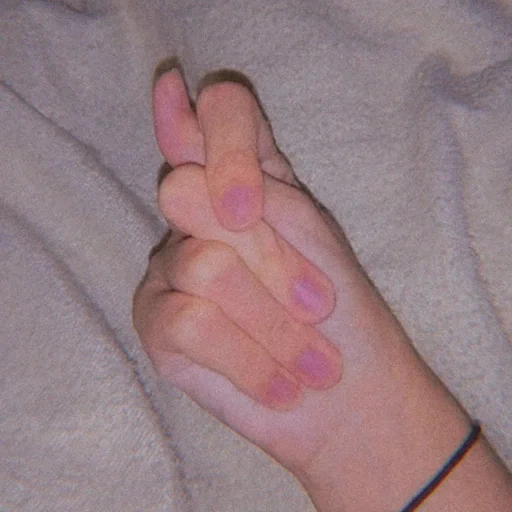 mão, palma, dedos, queima de mão, parte do corpo