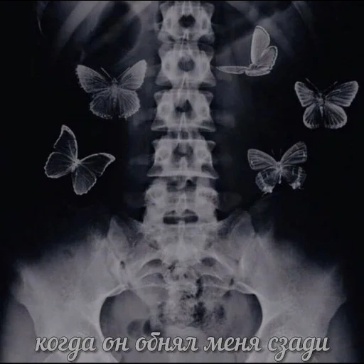 рентген, бабочка животе, обложка к песне, бабочки моём животе, бабочки животе рентген