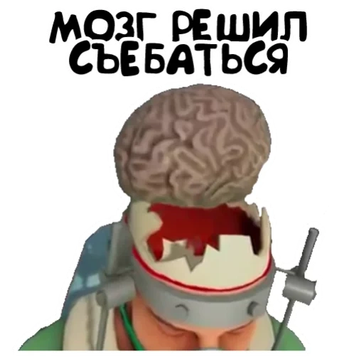 cerveau, meme brain, malmok brain, simulateur de réalité virtuelle pour chirurgien, simulateur de chirurgien nintendo