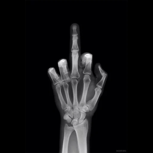 рентген, часть тела, x ray, рентгеновские лучи, рентген руки