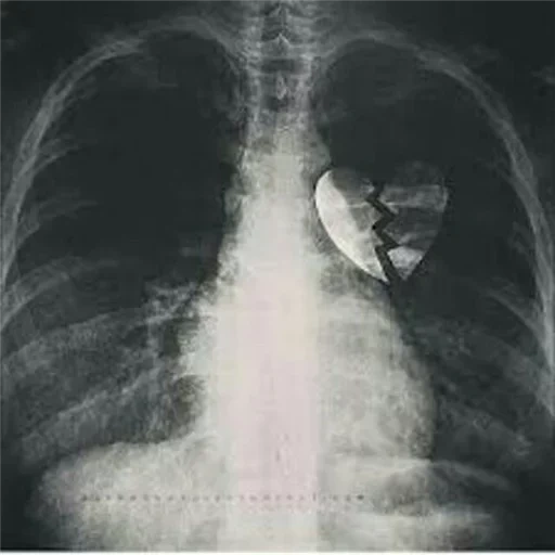 коскуль, казахстан, иллюстрация, рентген сердца, матвей смирнов