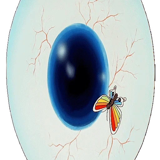 ovos, ovos de pato, marmelada de trolli eye, lentes multifocais, a estrutura da lente multifocal