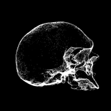 der schädel, das gif skelett, röntgenbild des schädels, röntgenbild des schädels, myelomatose schädel-röntgenstrahlen