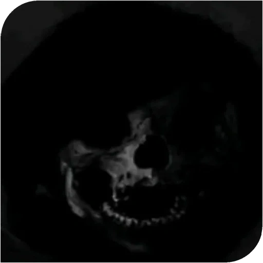 crâne, dark, os de crâne, le vieux crâne, black skull